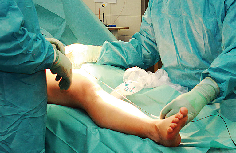 Klinikum Bad Salzungen Gefäßchirurgie