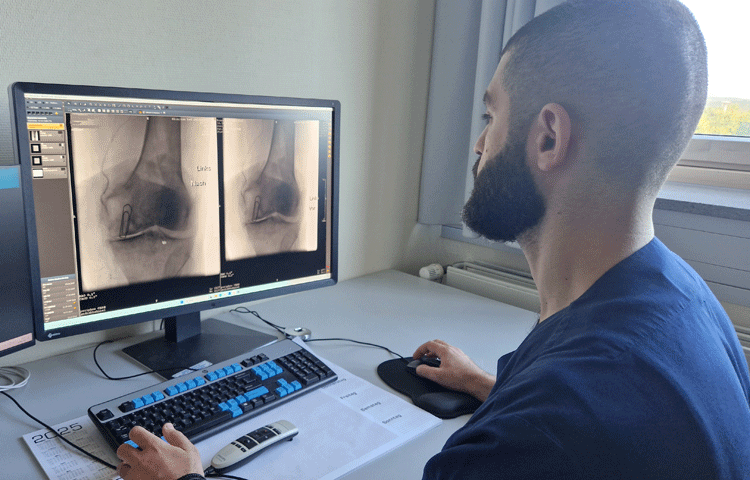 Knieembolisation web